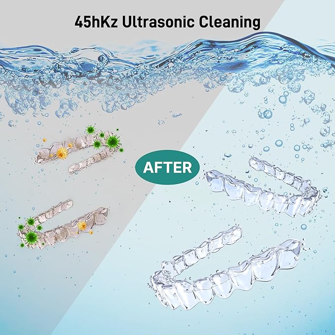 Ultrasonic Retainer Cleaner, Dental Cleaning Pod with U-V Lights, 45kHz Retainer Cleaner Machine for Dentures, Toothbrush Heads, Jewelry, Aligner, Night Mouth Guards (Pink)