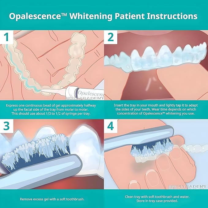 Opalescence 15% - Gel Syringes Teeth Whitening Refill Kit - Low Sensivity (8 Syringes) - Carbamide Peroxide - Cool Mint- Made in The USA by Ultradent - Tooth Whitening 5195-4
