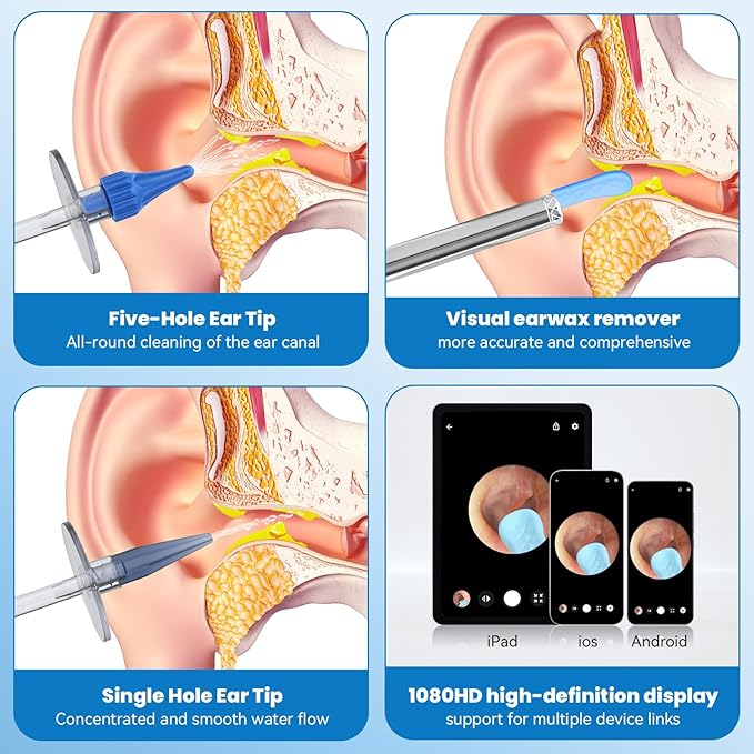 Ear Wax Removal - Ear Cleaner - Ear Camera - FSA HSA Eligible - Ear Wax Removal Kit - Ear Wax Removal Tool Camera - 1080HD Effective for Cleaning Ear Wax Build-Up