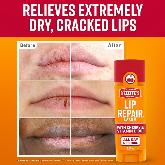O'Keeffe's Lip Repair Lip Balm with Cherry & Vitamin E Oil - Stick (3 Pack) - Moisturizer for Extremely Cracked, Dry Lips