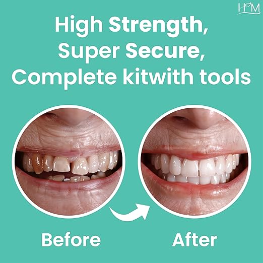 HM Zinc Oxide Eugenol Dental Cement Kit | Super Adhesive | Instant Tooth Repair, Cap, Crown & Bridge Filling | DIY, Self Curing, Sturdy & High Strength |Universal Shade| Emergency Dental Care | 1 Box