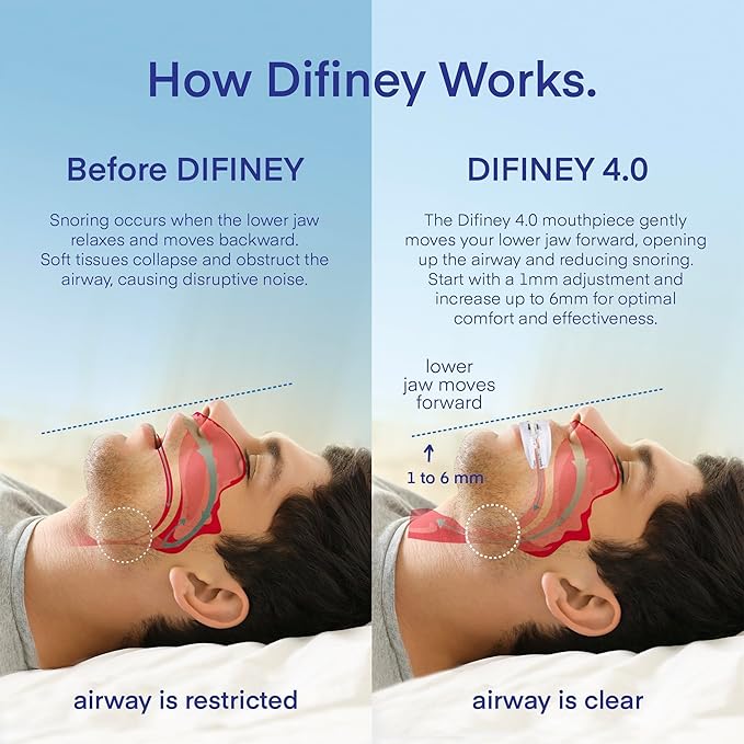 Advanced Anti Snoring Device 4.0 Clear: Adjustable Custom-Fit Anti Snoring Mouthpiece Mouth Guard for Men and Women - Effective Comfortable Anti Snore Solution