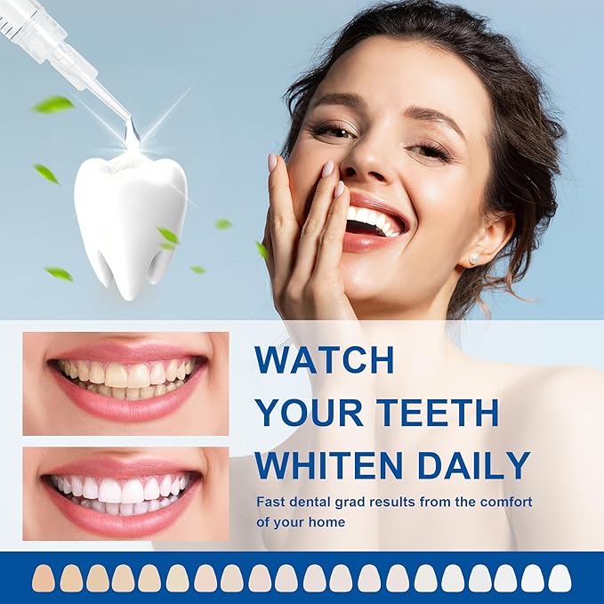 LUCKIN SMILE 10 * 3ML Teeth Whitening Gel Refill, 22% Carbamide Peroxide Suitable for Sensitive Teeth Whitening, 60 Whitening Treatments, Teeth Whiteners Used in Conjunction with Teeth Whitening Kit