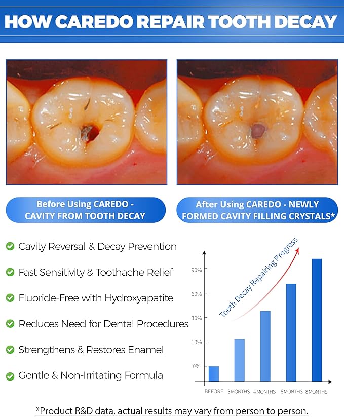 Cavity Reversal Hydroxyapatite Toothpaste for Adults, Cavity Tooth Filler as Home Cavity Repair, Fluoride Free Reverse Cavities Treatment for Tooth Decay Repair, Remineralizing Repair 3.52OZ