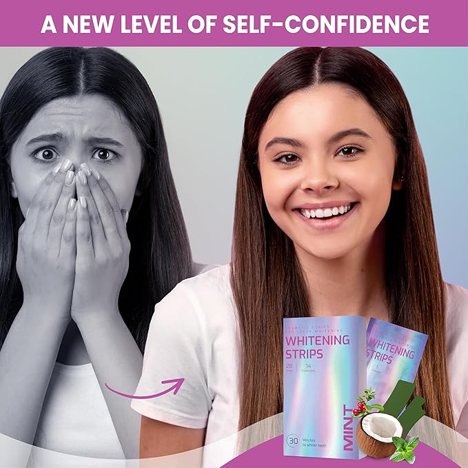 Gentle Teeth Whitening Strips - (28 Stripes) Bleaching Teeth Free of Peroxide for a Radiant Smile - Gentle Tooth whitening