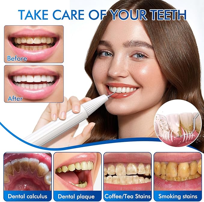 The Model 3003 Scaler Plaque Tartar Remover for Teeth Cleaning with 3 Modes and 5 Heads - Portable Cordless Dental Calculus Teeth Cleaner - Rechargeable Teeth Cleaning Tools Kit for Home, Travel