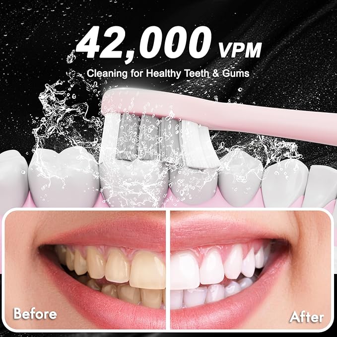 Diamond Style - Sonic Electric Toothbrush for Adults & Kids, Rechargeable Toothbrushs with 10 Brush Heads & Travel Case, Teeth Whitening, Power Electric Toothbrush with Holder