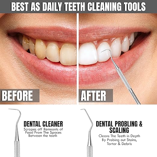 Professional Dental Tools Tartar Scraper for Dentist, Personal Use and Pets Stain Plaque Remover for Teeth, Premium Oral Care Double Ended Dental Probe Scaler | Stainless Steel