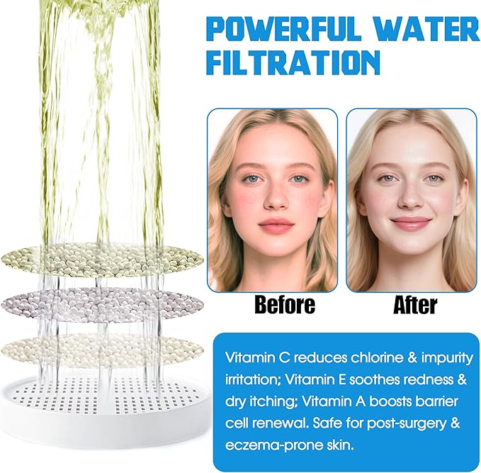 xcivi Vitamin C + E + A Shower Filter Replacement Cartridge for Aquahomegroup Shower Head, Shower Head Filter Supports Healthier Skin, Hair & Nails - 3 Packs